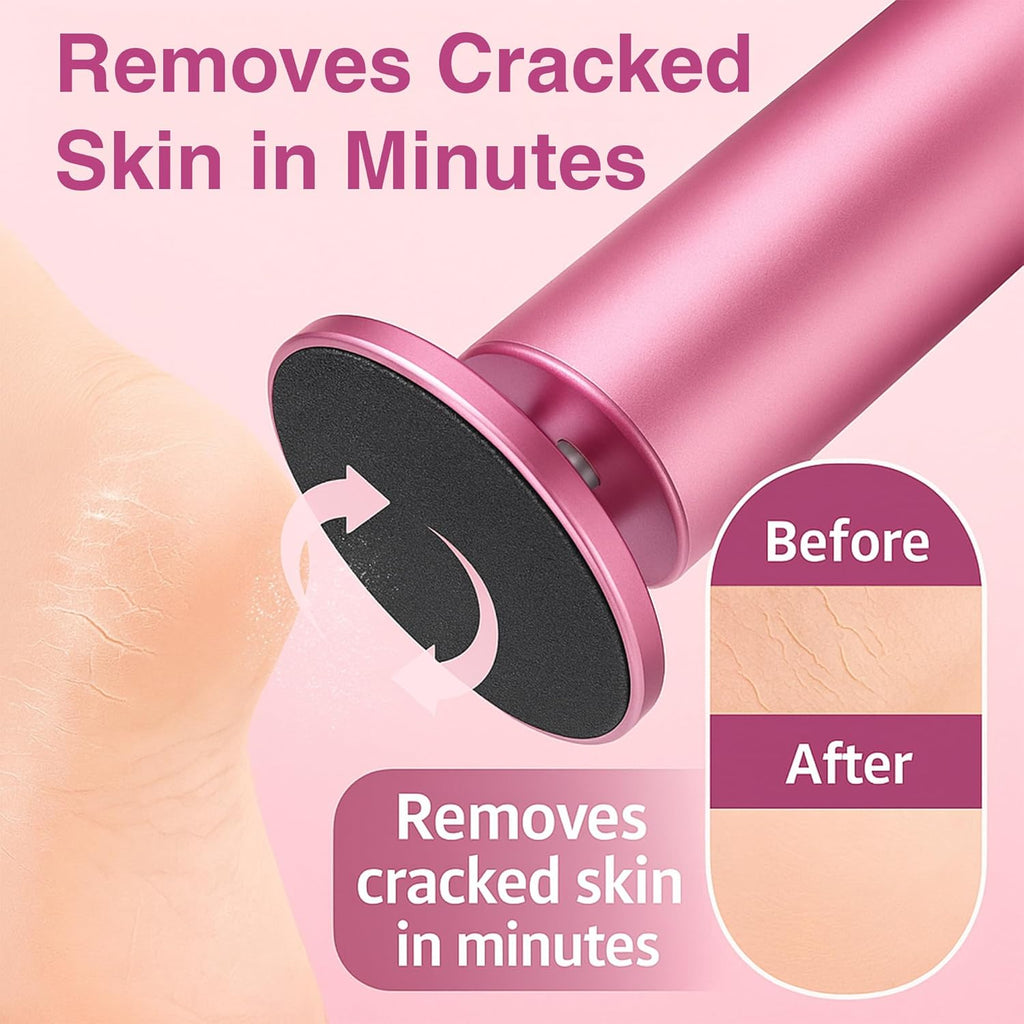 Electric Foot Callus Remover