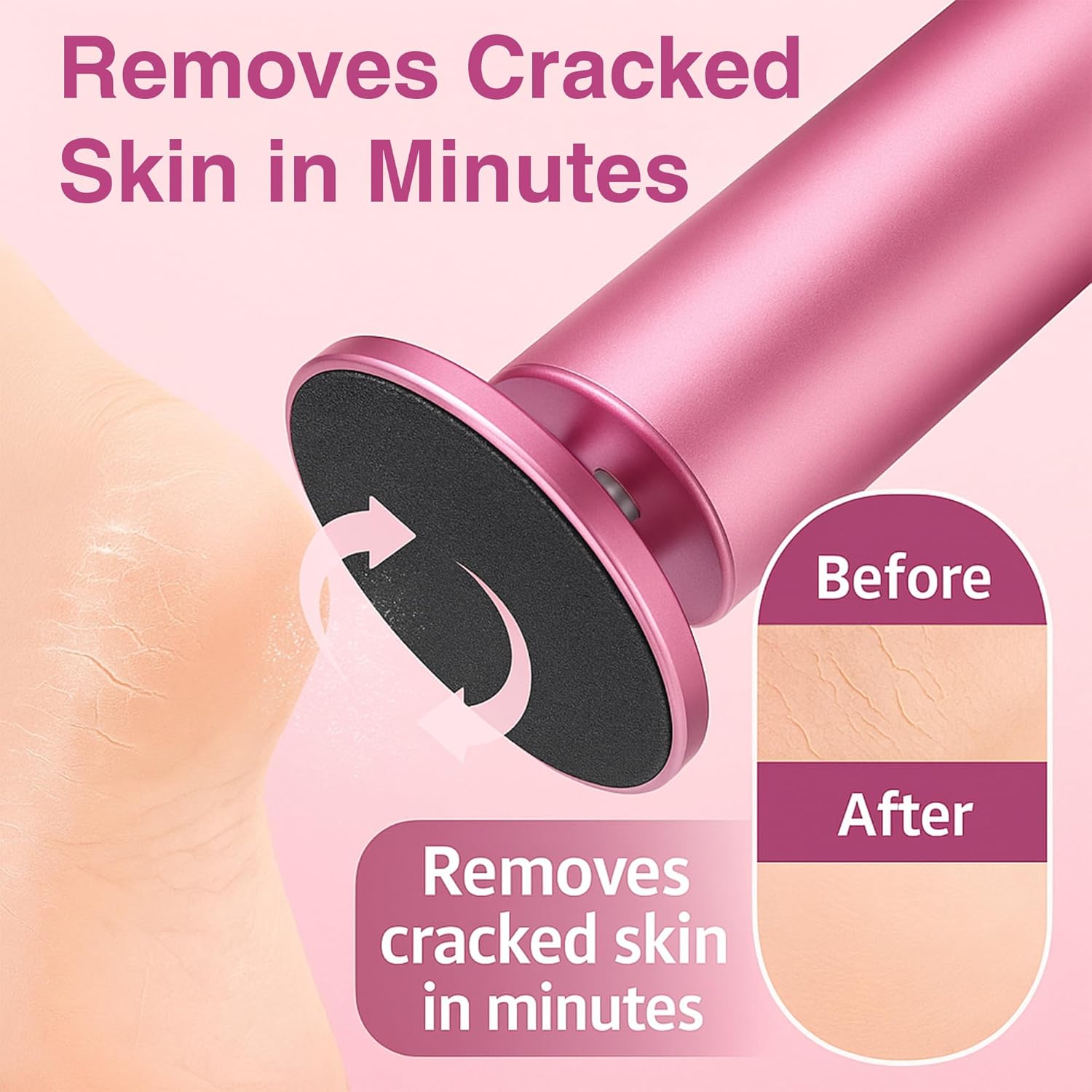 Electric Foot Callus Remover