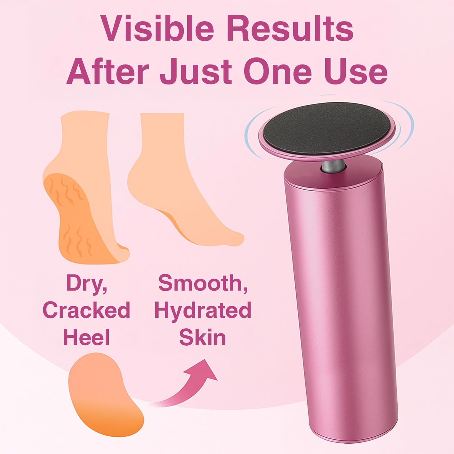 Electric Foot Callus Remover